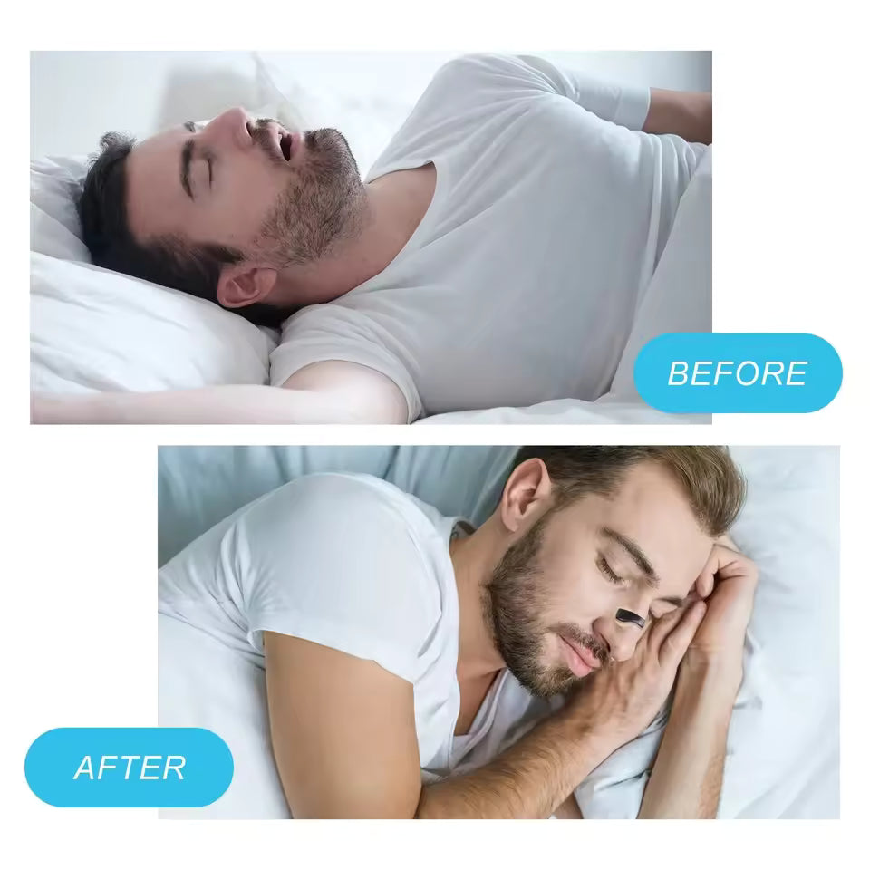 Intake 30-Day Refills